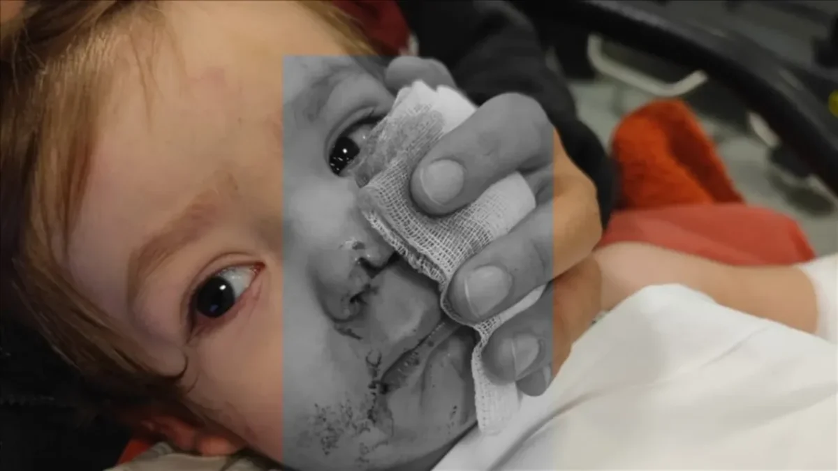 ETİMESGUT’TA PİTBULL SALDIRISI DAVASI: SAHİBİNE 7,5 YILA KADAR HAPİS TALEBİ