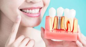 Her diş kaybı implant gerektirir! Dişsiz kalmak çene kemiğini eritiyor